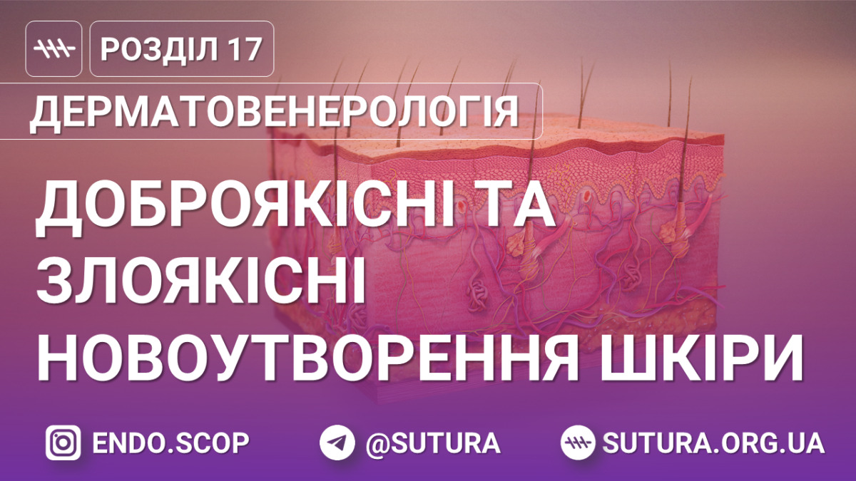 Доброякiснi та злоякiснi новоутворення шкiри