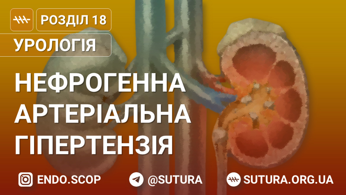 Нефрогенна артеріальна гіпертензія