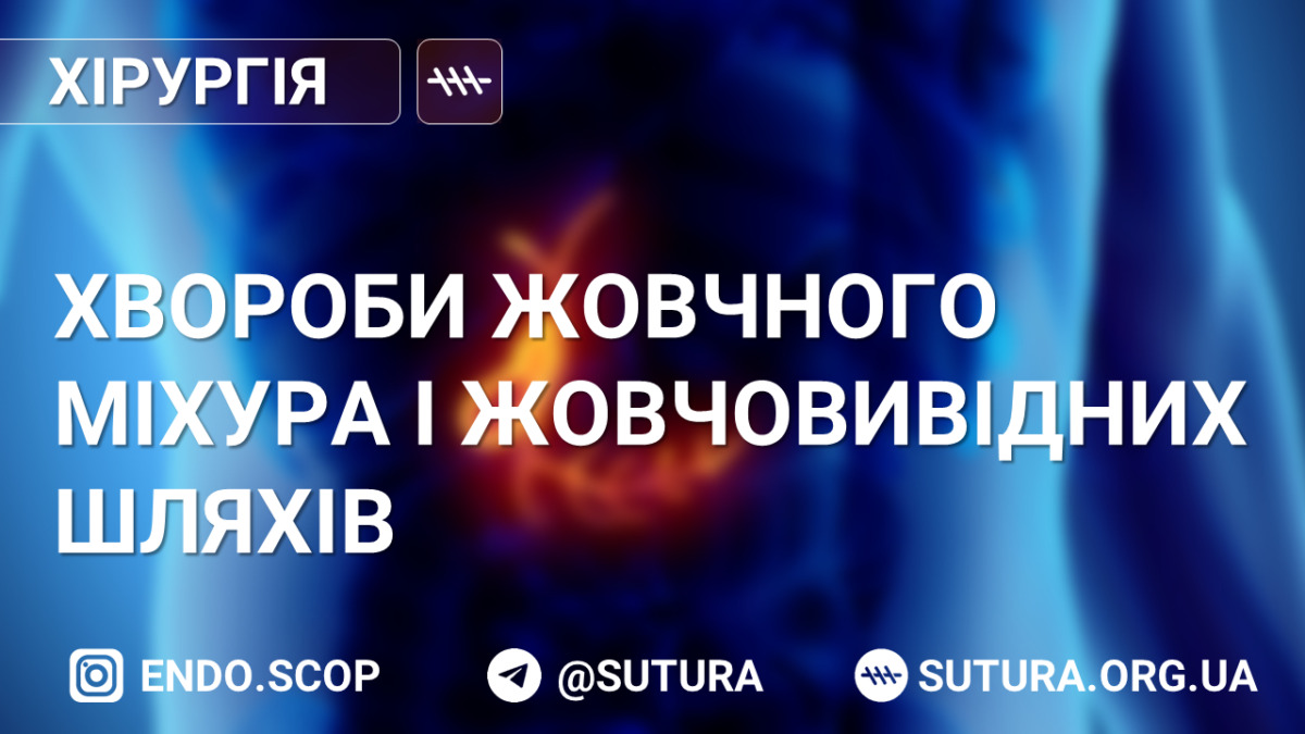 Хвороби жовчного міхура і жовчовивідних шляхів