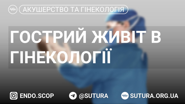 Гострий живіт в гінекології