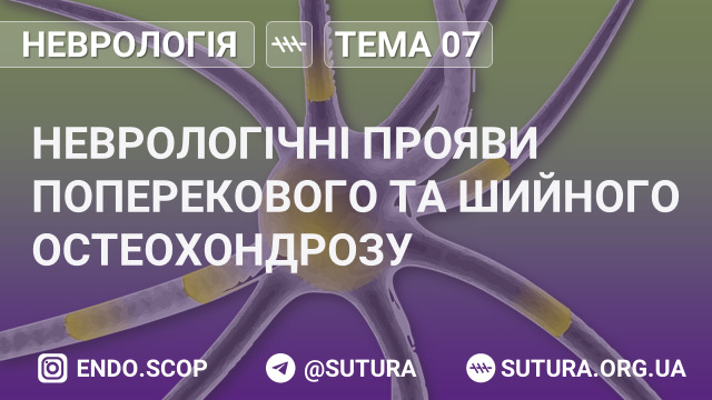 Неврологічні прояви поперекового та шийного остеохондрозу