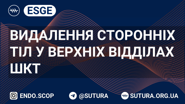 Видалення сторонніх тіл у верхніх відділах ШКТ