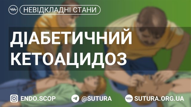 Гостра декомпенсація цукрового діабету, що харак­теризується значною гіперглікемією, гіперкетонемією, ацетонурією, метаболічним ацидозом.