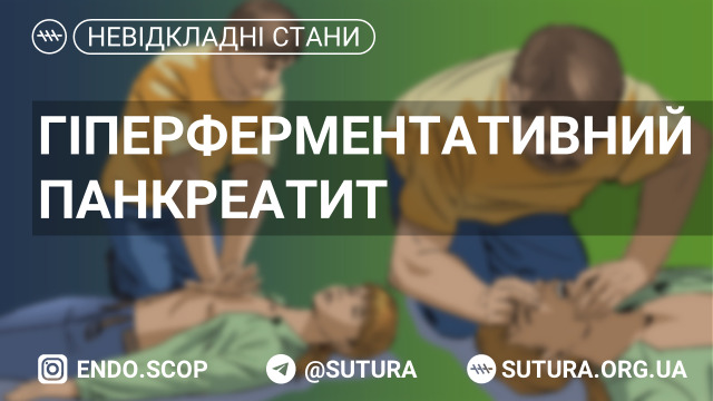 Гіперферментативний панкреатит невідкладні стани