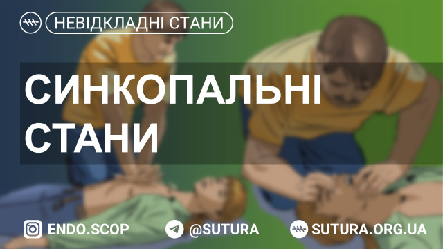 Тимчасова втрата свідомості у зв’язку з транзитор­ною глобальною церебральною гіпоперфузією, що характеризуєть­ся швидким початком, короткою тривалістю і спонтанним повним відновленням.