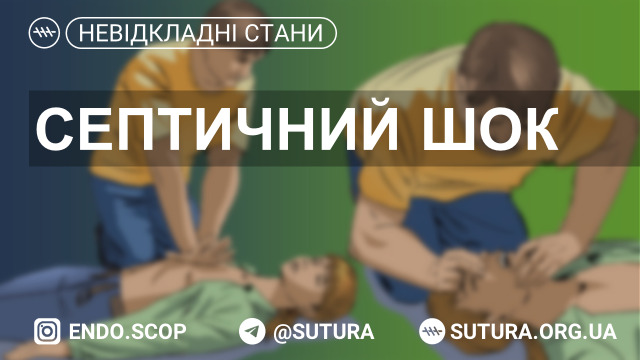 Синдром недостатності перфузії тканин із неадекватною доставкою та споживанням кисню, що супроводжується артеріальною гіпотонією (САТ < 90 мм рт. ст. або його зниження на 40