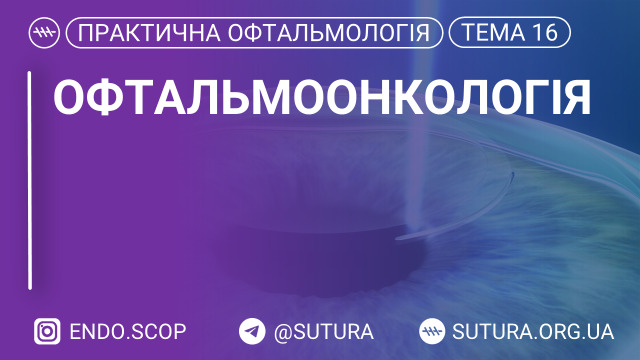 Офтальмоонкологія