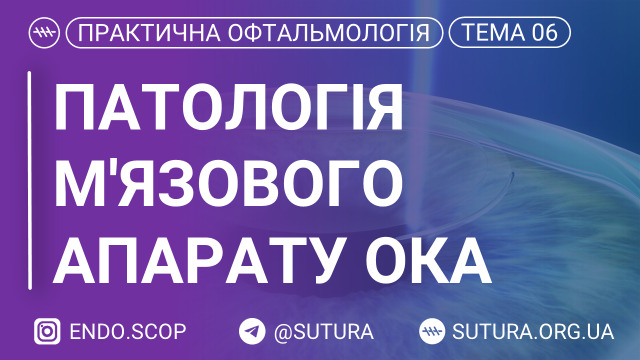 Патологія м'язового апарату ока