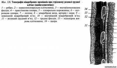 Грудна стінка