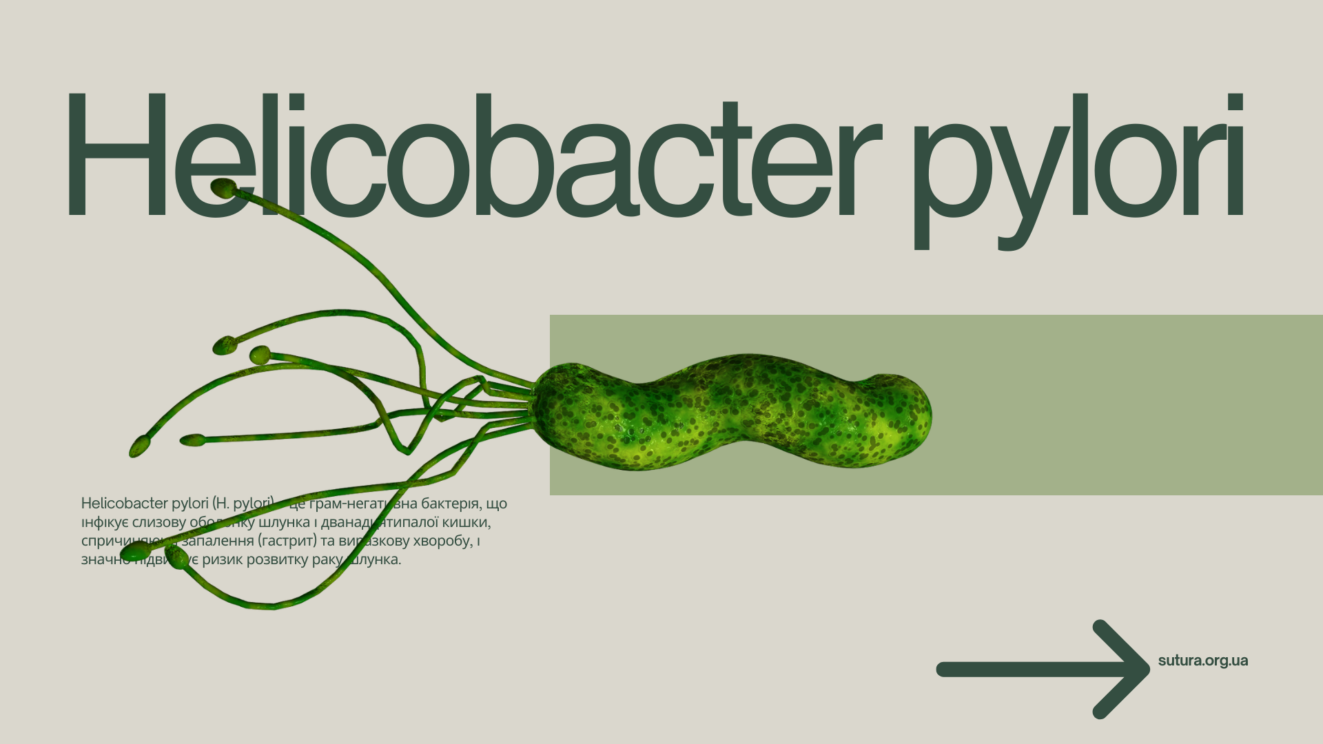 Helicobacter pylori: сучасні підходи до діагностики та ерадикації
