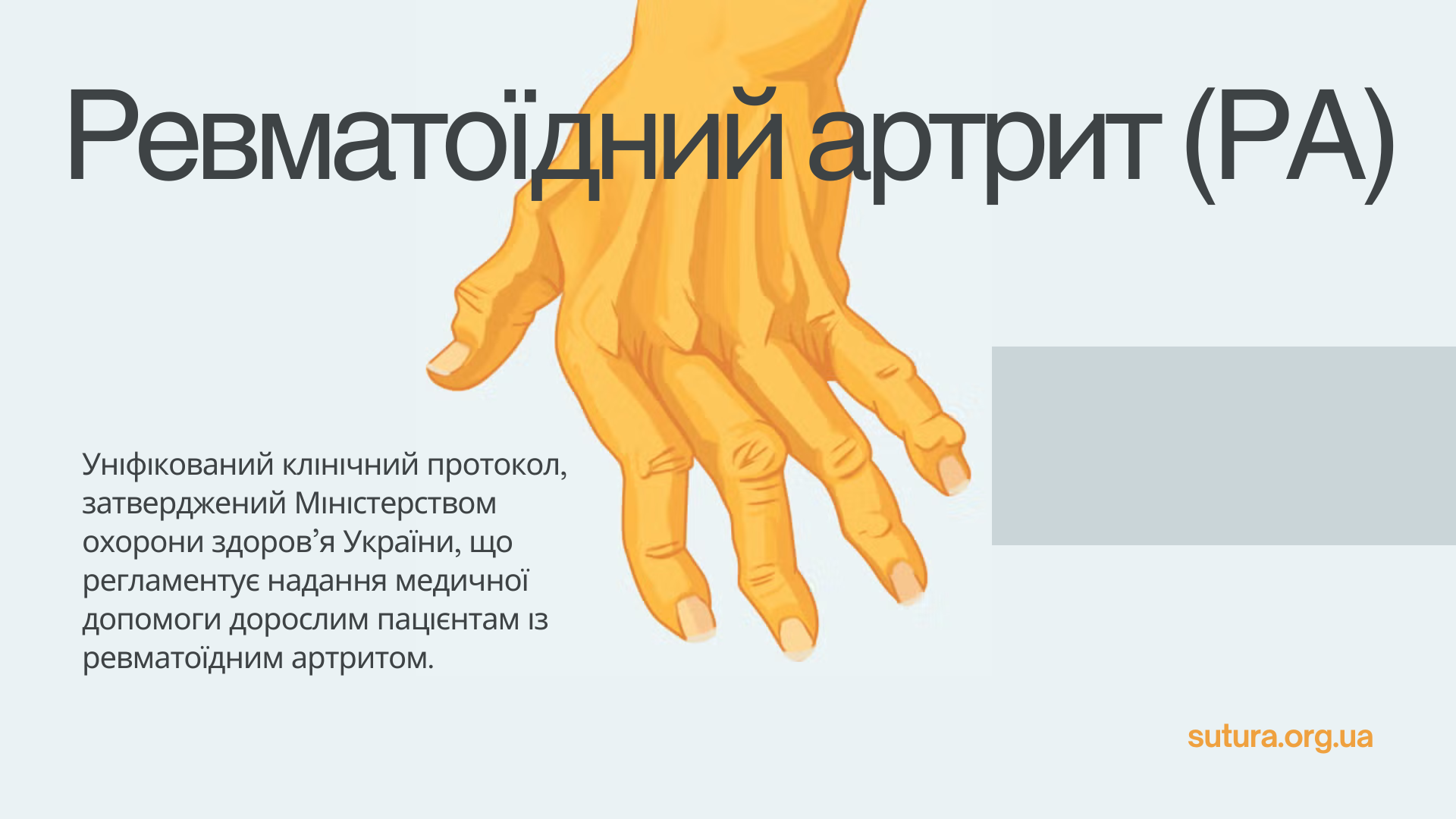 Уніфікований клінічний протокол, затверджений Міністерством охорони здоров’я України, що регламентує надання медичної допомоги дорослим пацієнтам із ревматоїдним артритом.